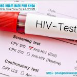 Thời Gian Thích Hợp Để Xét Nghiệm HIV Sau Khi Bị Phơi Nhiễm